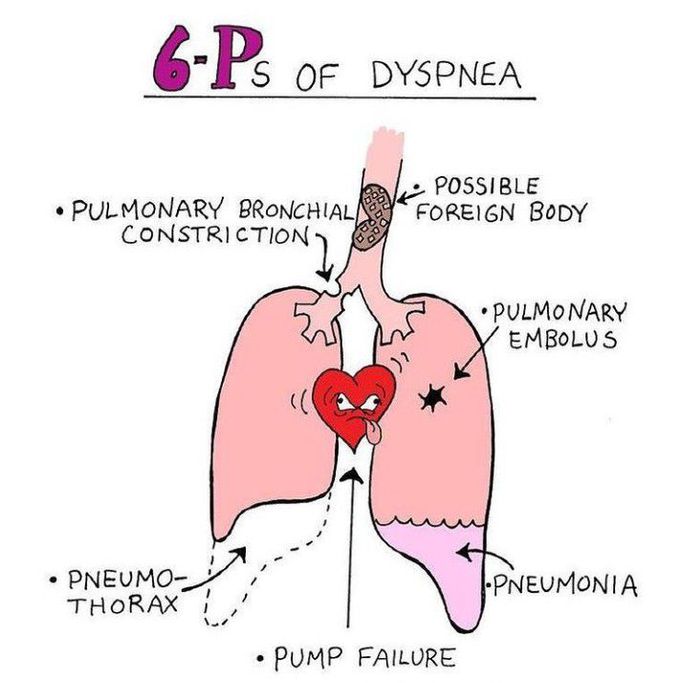 6Ps of Dyspnea