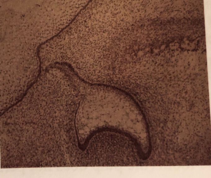 Dental development- what stage?