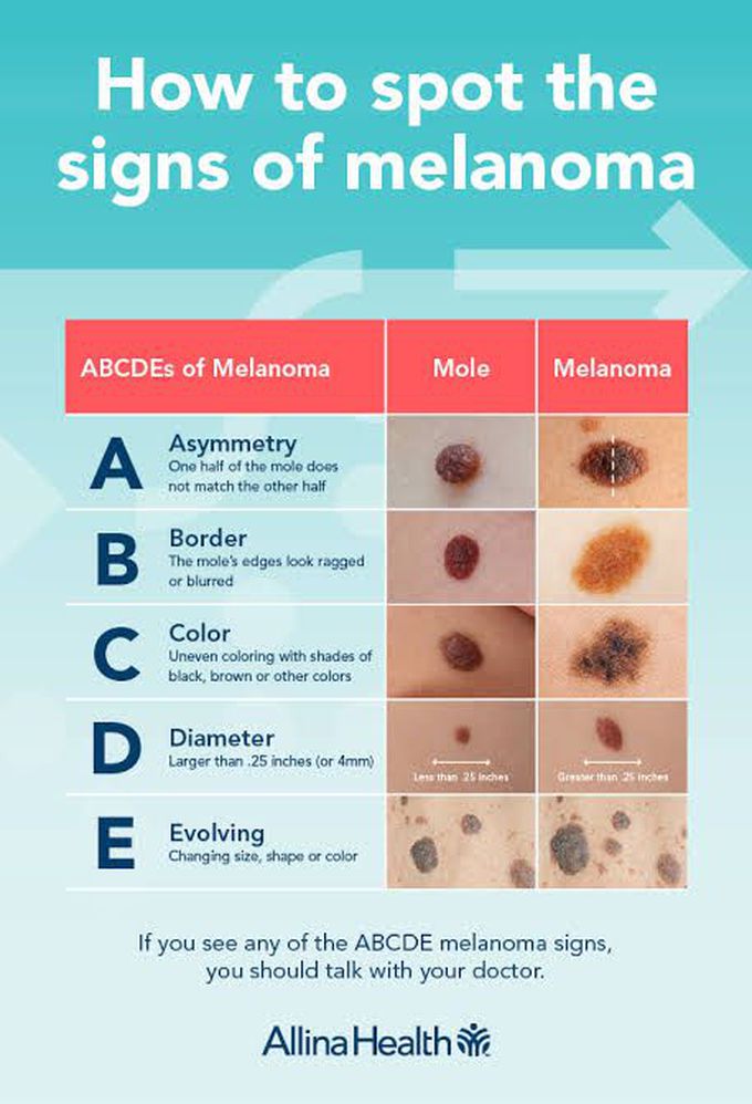 Melanoma MEDizzy