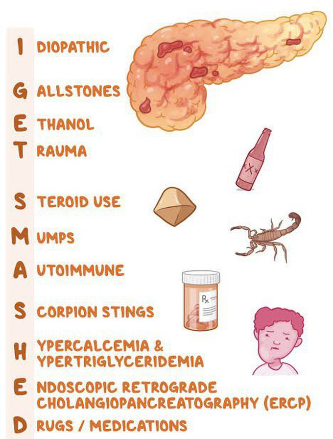 Causes of pancreatitis