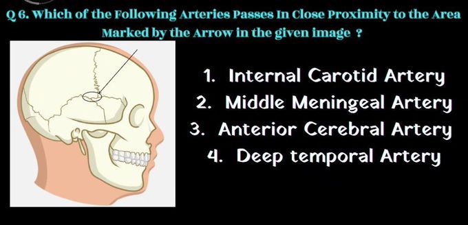 Identify the Artery