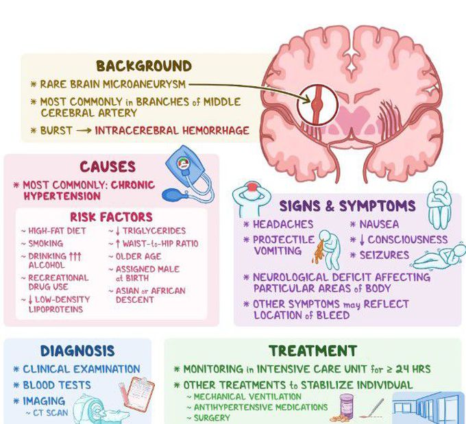 Charcot Bouchard Syndrome