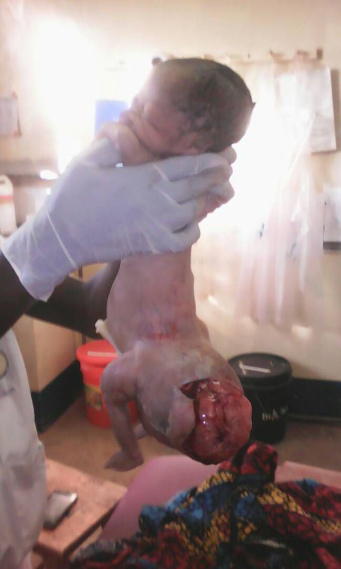 Dear doctors,Your Diagnosis and management please...