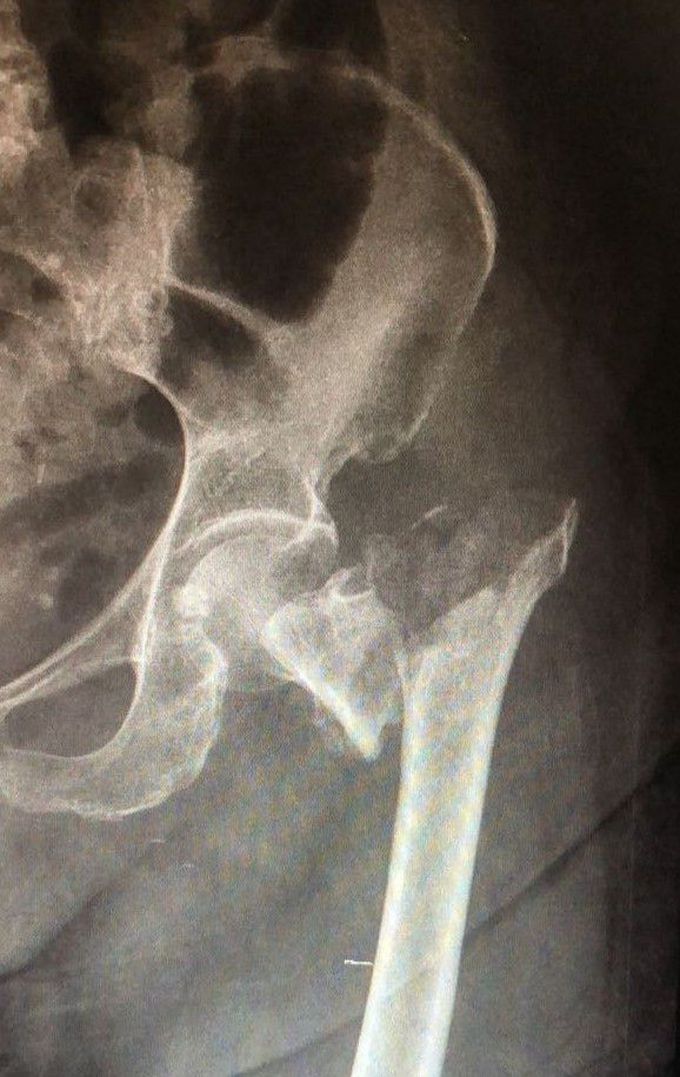 X Rays  😲