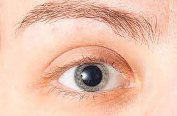 What do dilated pupils look like?