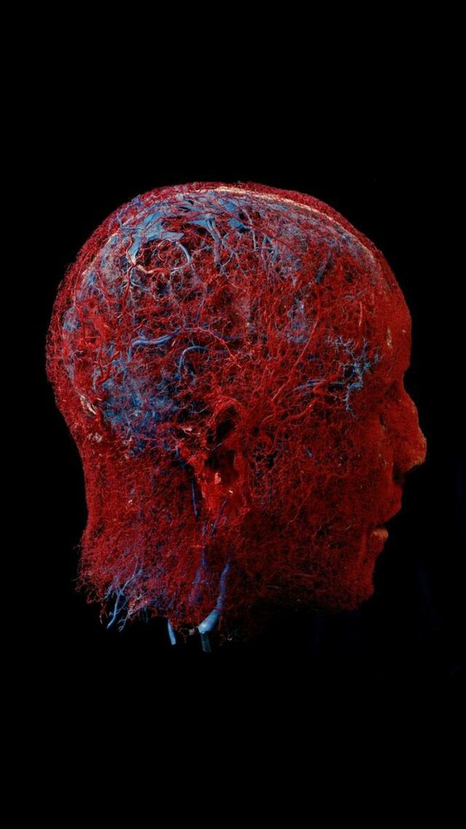 Blood vessels in the brain