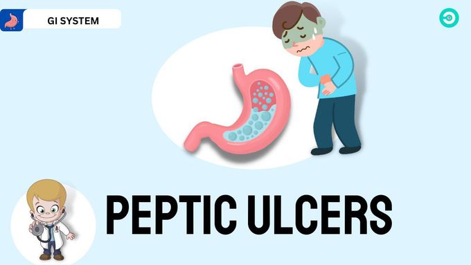 Peptic Ulcer Disease: Everything you need to know
