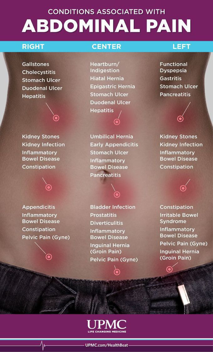 Conditions Associated With Abdominal Pain