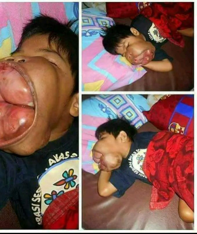 What is your diagnosis