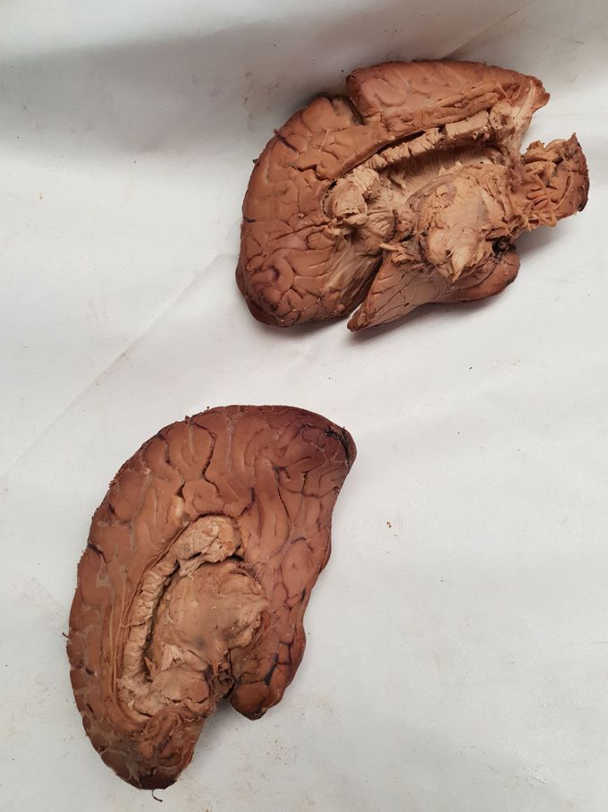 Human Brain...