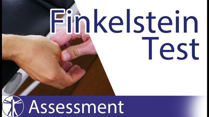 Positive Finkelstein Test in De Quervain's Tenosynovitis