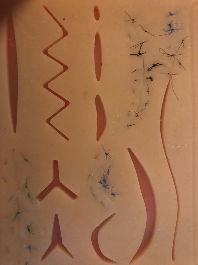 Sutures
