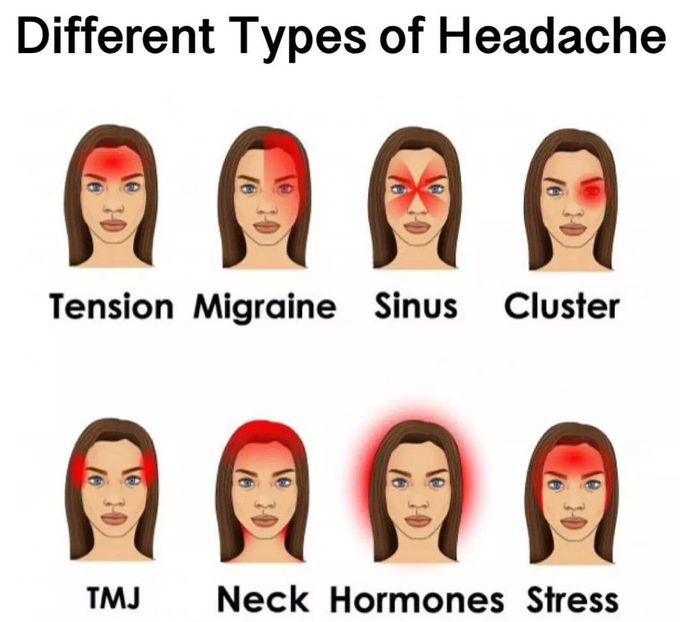 Different Types of Headache