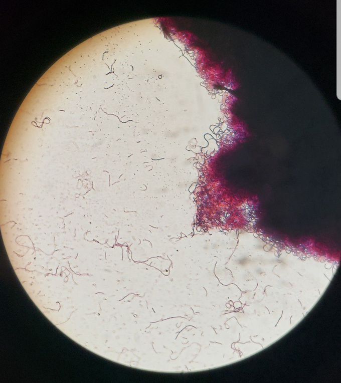 Bacillus subtilis