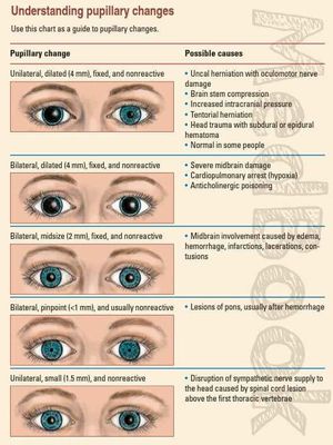 Pupillary changes.... - MEDizzy