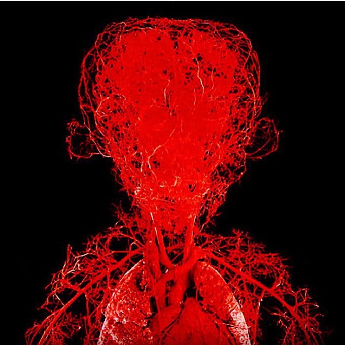 The vascular system of a human body