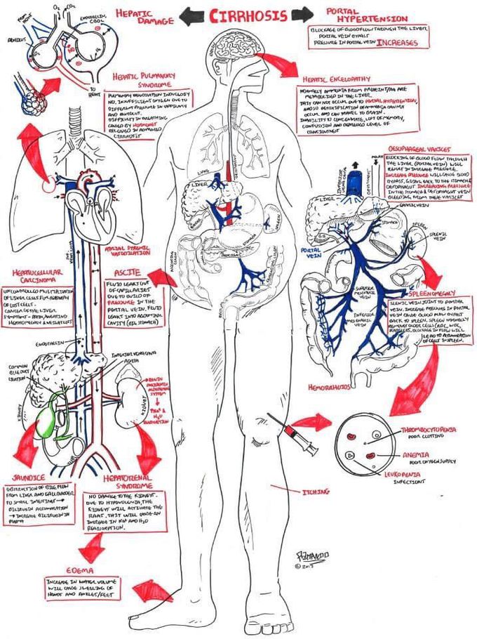 Liver death