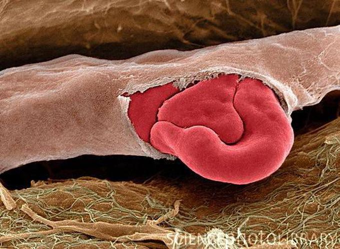 Ruptured capillary with red blood cells spilling out. - MEDizzy