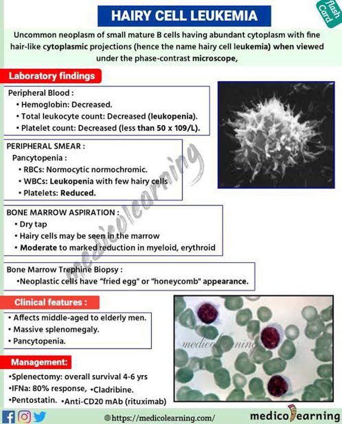 Hairy Cell Leukemia