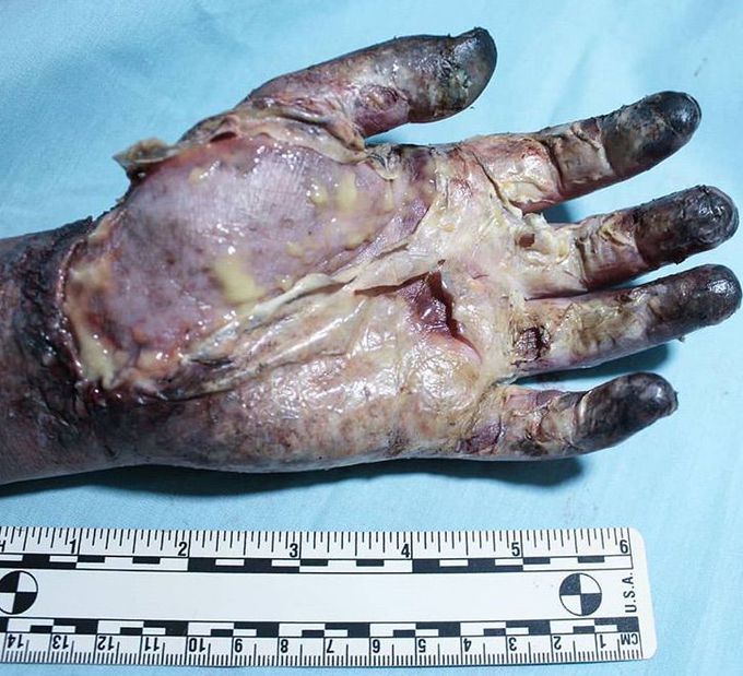 What is your diagnosis??