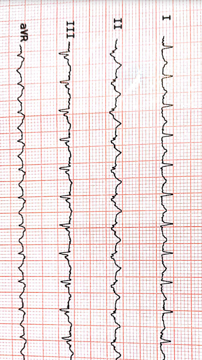 diagnosis?