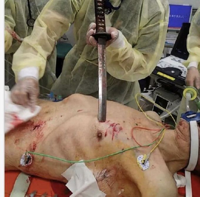Trauma