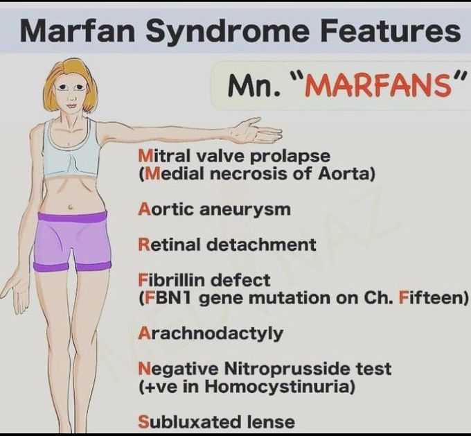 Marfan syndrome