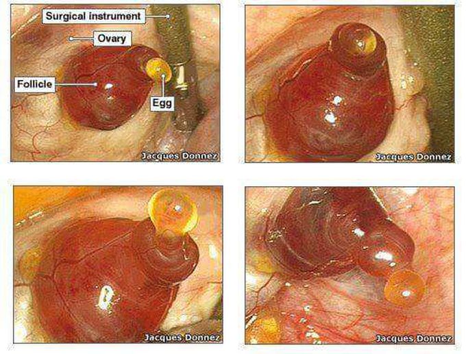 Ovulation First pic