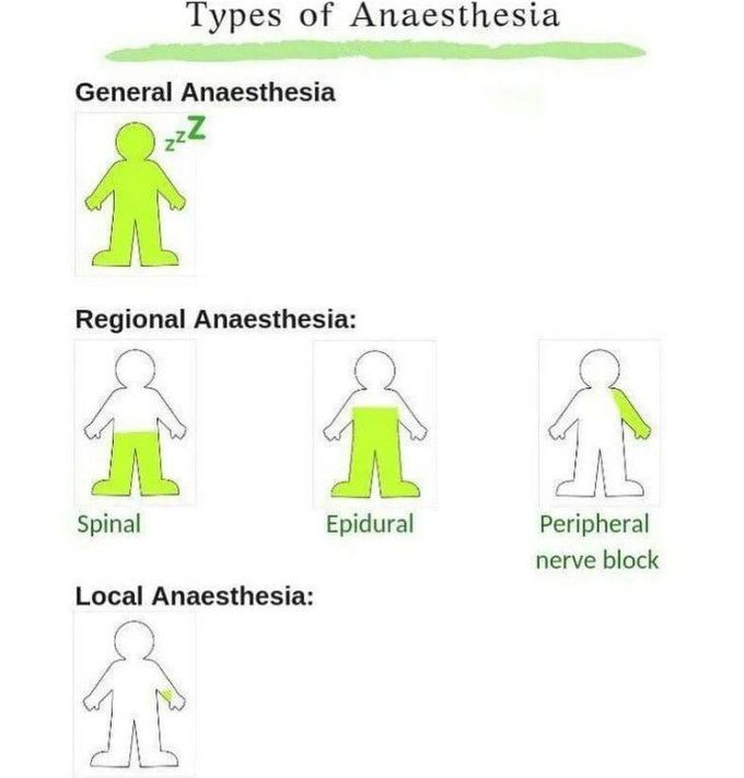 Types of Anesthesia