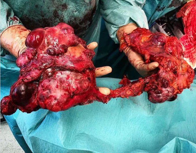 general surgery