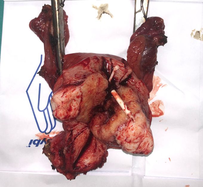 What is the diagnosis?