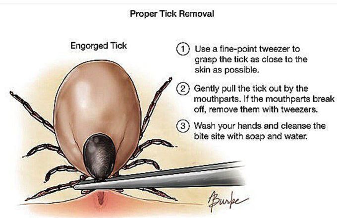 How to remove engorged tick.