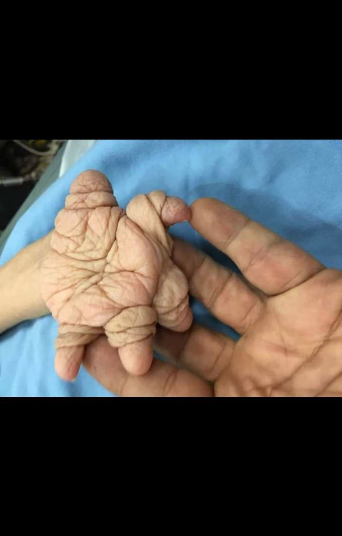 Diagnosis?