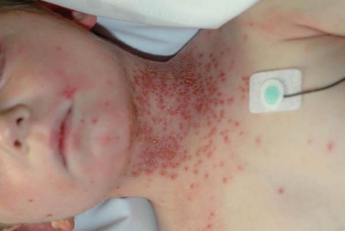 What's your diagnosis?