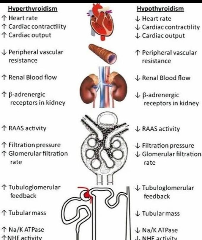 Difference between HYPER- and  HYPO- THYROIDISM