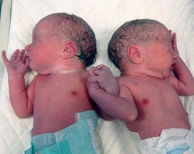 Very precious shot of twins holding hands right after they were born ❤️