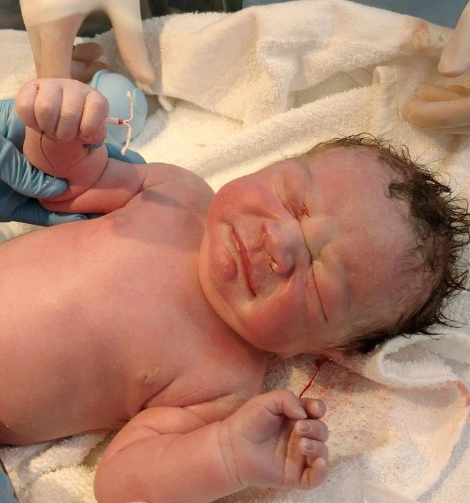 Baby boy born with Mother’s birth control device in hand!