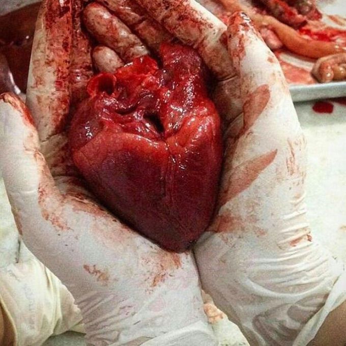 😍♥️