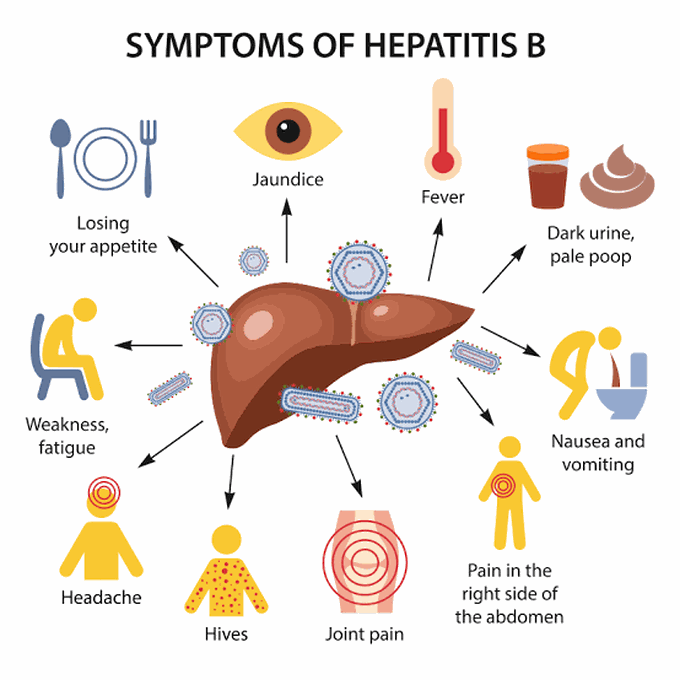 Symptoms of Hepatitis B