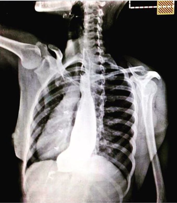 What is your diagnosis?