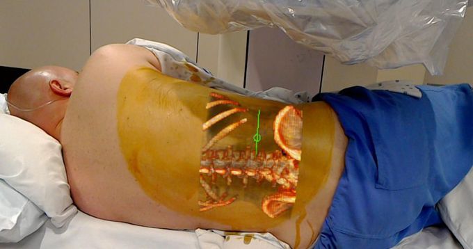 FDA approves first Microsoft HoloLens augmented reality system for surgical use