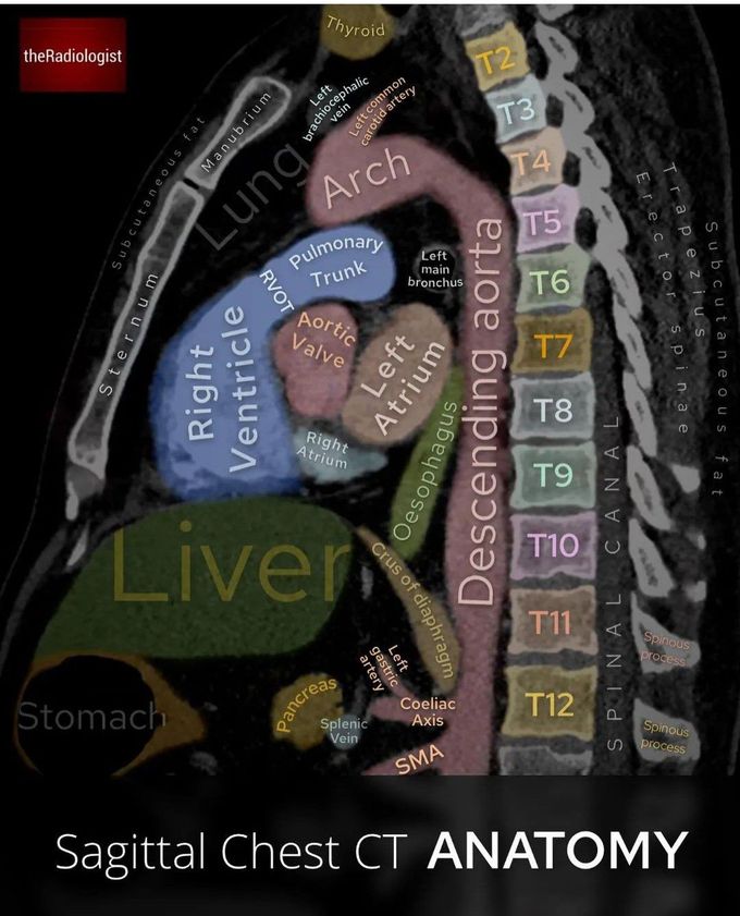 Saggital Chest CT Anatomy