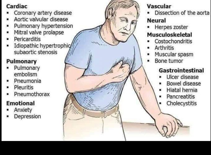 Common causes of chest pain.