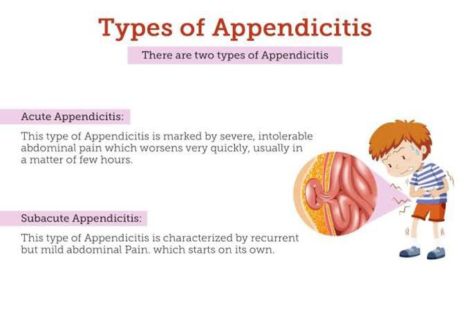 Appendicitis -Types