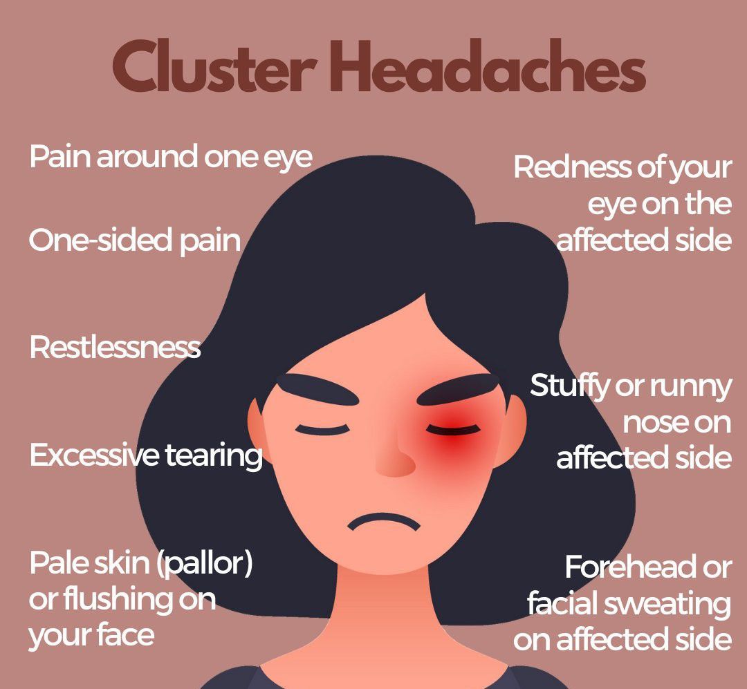 Cluster Headache - MEDizzy
