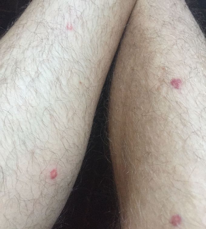 Diagnosis?