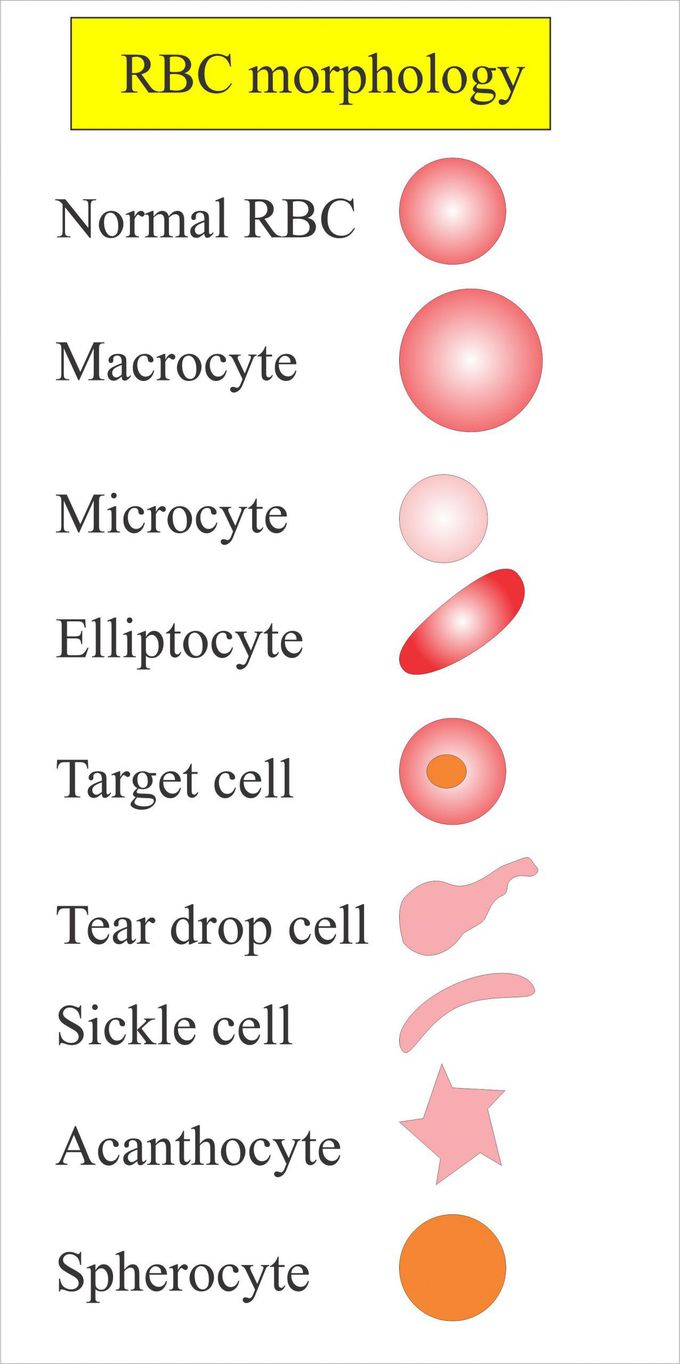 tear drop cells