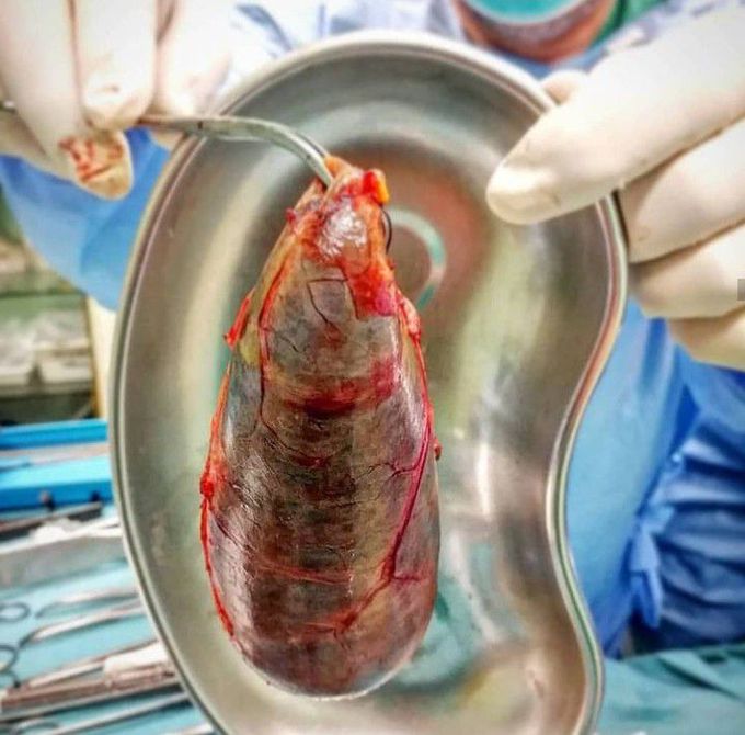 General surgery