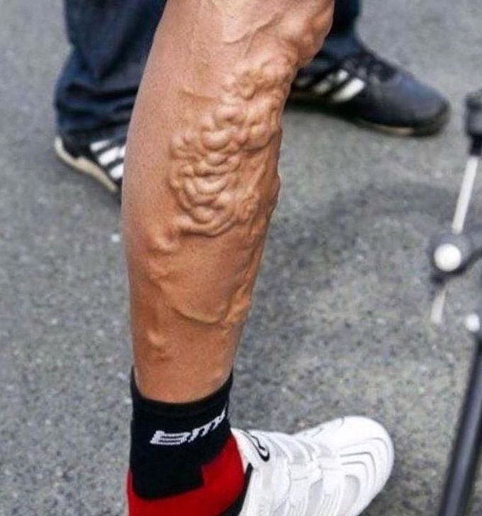 What is the name of this condition??