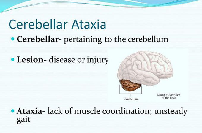 Cerebellar Ataxia